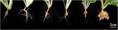 Histopathology of the Plasmodiophora brassicae-Chinese Cabbage Interaction in Hosts Carrying Different Sources of Resistance